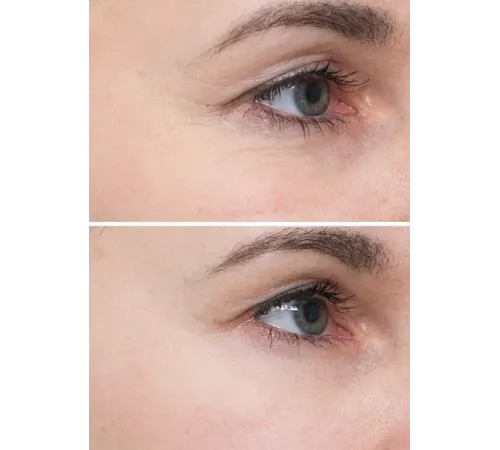 INSTYTUTUM Подушечки з кислотами для глибокого відновлення шкіри Flawless Pads 60шт